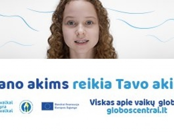 „Mano akims reikia Tavo akių“